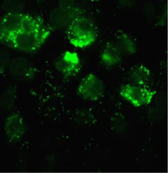RSV infected A549 cells
