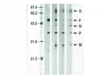 RSV proteins