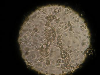 RSV syncytia