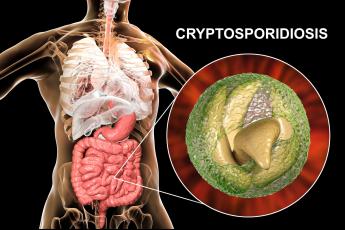 Cryptosporidiosis