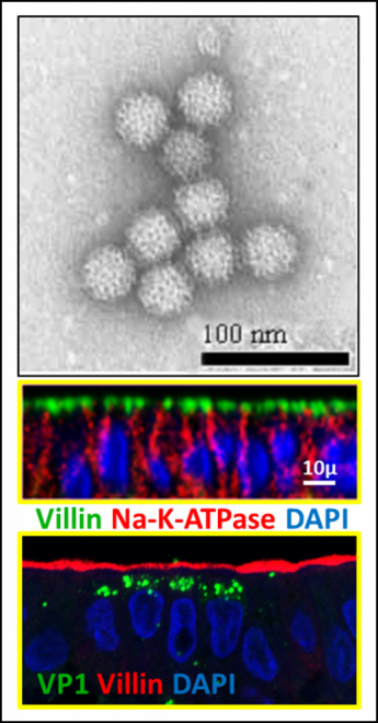 Norovirus particles