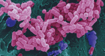 Electron micrograph of the attachment of enteroaggregative E. coli